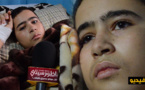 خطير بالناظور: 40 كلب يتهجمون على تلميذ فيرسلونه إلى الإنعاش بعد تهشم قفصه الصدري ووالده يناشد مساعدته
