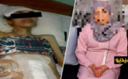 حالة إنسانية مؤلمة.. شابة بالناظور تعاني في صمت بسبب مرض خطير وتخلي الزوج عن إعالتها