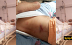 خطير.. شرطي يرسل طالب في الطب الى العناية المركزة بالناظور بعدما دهسه بسيارته