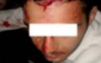 الشرطة الإسبانية تعتقل نجل ملياردير مغربي بسبب الضرب والجرح داخل ملهى ليلي بماربيا