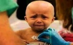 نشطاء يثمنون مبادرة علاج أطفال السرطان مجانا ويطالبون تعميمها