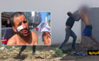 شاهدوا.. حارس السيارات ضحية الاعتداء من طرف "حراكة" بالناظور يروي تفاصيل الواقعة