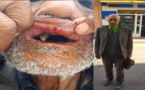 مختلّ عقليا يعتدي على سبعيني في الدريوش ويرسله إلى المستعجلات