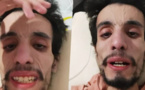 بعد سنوات من التحمّل في صمت.. شاب مغربي يناشد المحسنين والأطباء إنقاذ حياته