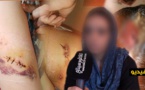 شاهدوا.. زوج يوجّه طعنات خطيرة لزوجته والأخيرة تناشد الأجهزة الأمنية والقضائية بالناظور اعتقاله