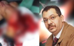 في عملية جراحية معقدة بالناظور الدكتور الصبار ينقد ساق شاب من البتر 