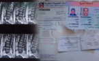 سيدة ناظورية تناشد المحسنين مساعدتها على مصاريف عملية مستعجلة على مستوى العمود الفقري