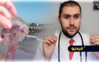 الدكتور أبركان يقدم نصائح بالأمازيغية حول ما يجب القيام به عند التعرض للسعة قنديل البحر