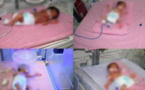 غير بعيد عن الناظور.. سيدة عشرينية تنجب 4 توائم إناث