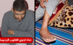 عائل أسرة مقعد عن العمل يعاني اعتلال الكليتين وضعف البصر وتورم القدم يناشدكم مساعدته
