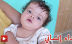 طفلة تعاني من مرض في عمودها الفقري تناشد المحسنين لإعانتها في إجراء العملية