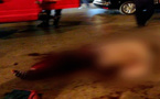 قطعة نقدية قيمتها 5 دراهم كادت تزهق روح شابٍّ تلقّى عنها غرس آلة حادة في بطنه بالناظور