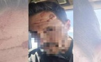 مهاجر إفريقي يهاجم حارس حدود إسباني بسلاح حاد في سبتة.. ومطالب بزيادة القوات