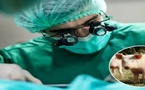 الصين تحقق سابقة عالمية.. زرع رئة خنزير معدل وراثيا في جسد بشري