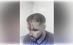 "اعتداء عنيف".. توقيف شخص اعتدى على طبيب بمستشفى  "اعتداء عنيف".. توقيف شخص اعتدى على طبيب بمستشفى