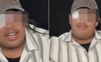 بسبب ضغط العمل.. صانع محتوى مغربي يكشف تفاصيل فقدانه البصر بإحدى عينيه