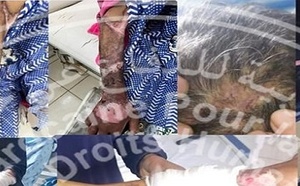 جمعية حقوقية تأمل في استئناف الحكم الصادر في قضية تعذيب العاملة المنزلية بالناظور