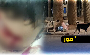  هجوم كلاب ضالة يصيب طفلين بجروح خطيرة بالناظور