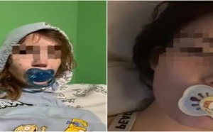 انتشار موضة “اللهاية” بين الشباب.. أطباء يحذرون من أضرار خفية