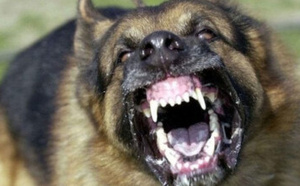 الحسيمة.. هجوم كلب ضال على تلميذ أمام مدرسة ابتدائية يثير الهلع