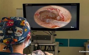 المغرب يحقق إنجازا طبيا نادرا: أول زراعة قوقعة سمعية بتقنية الأندوسكوب في المملكة