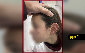 تعنيف تلميذة يجر أستاذة إلى شكاية رسمية بالناظور