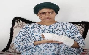 تازة: 130 غرزة على وجه إيمان.. والعدالة تقضي بالسجن 15 سنة للطليق