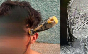 إسبانيا.. شاب مغربي ينجو من موت محقق بعد تعرضه لاعتداء من طرف جزائري بسبب خلاف مالي