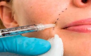 انتبهي قبل "الحقن".. إيداع أجنبية وزوجها وصاحب صالون تجميل السجن