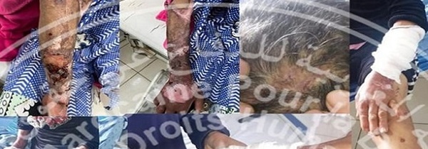جمعية حقوقية تأمل في استئناف الحكم الصادر في قضية تعذيب العاملة المنزلية بالناظور