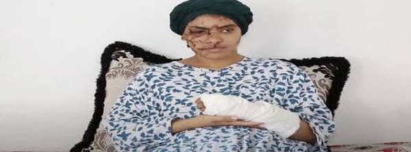 تازة: 130 غرزة على وجه إيمان.. والعدالة تقضي بالسجن 15 سنة للطليق