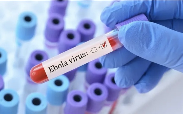 حقيقة تسجيل إصابة بفيروس "إيبولا" في مراكش