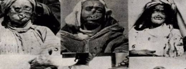 ملف الحرب الكيميائية في الريف وجبالة أمام الأمم المتحدة.. هذه أبرز المطالب